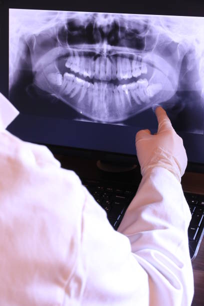 Best Emergency Wisdom Teeth Removal in Yoakum, TX