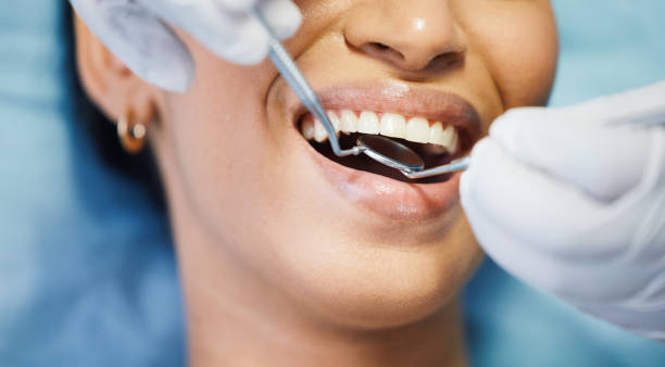 Best Walk-In Emergency Dentist in Yoakum, TX